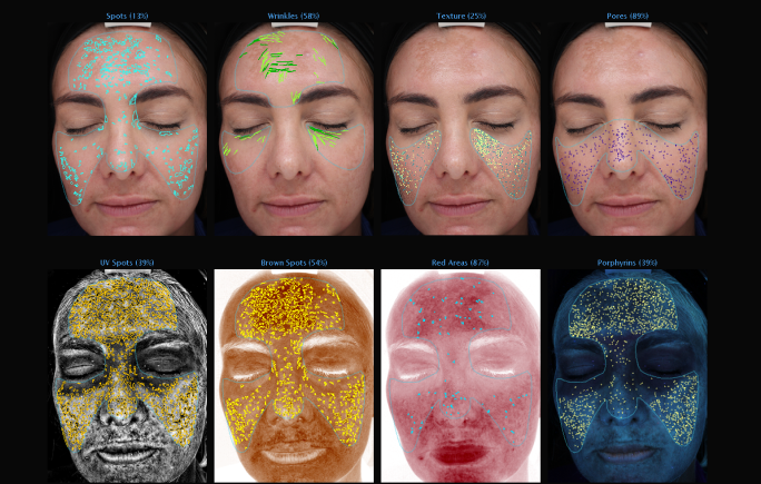 Skin Consultations | Clinic 805 | Victoria BC