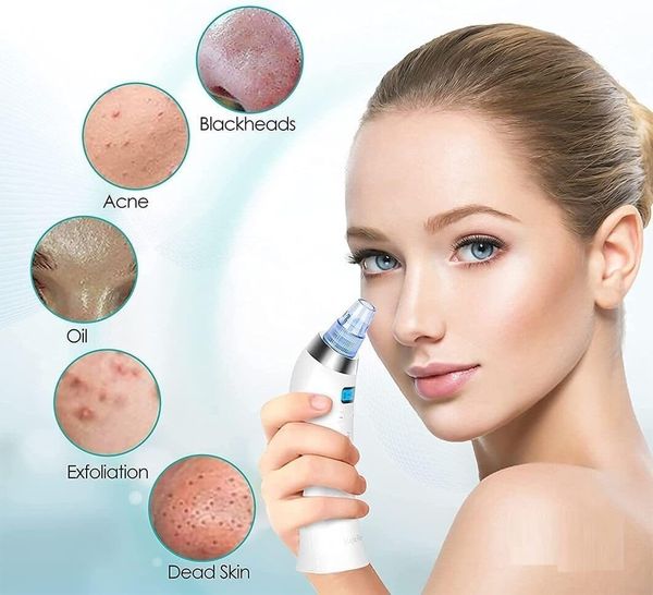 DERMA SUCTION, 4 in 1 Blackhead & Whitehead Remover Vacuum Device | Electric Facial Cleansing & Pimple Removal Tool | Deep Pore Cleaner Suction Tool for Men & Women (White)(2866)