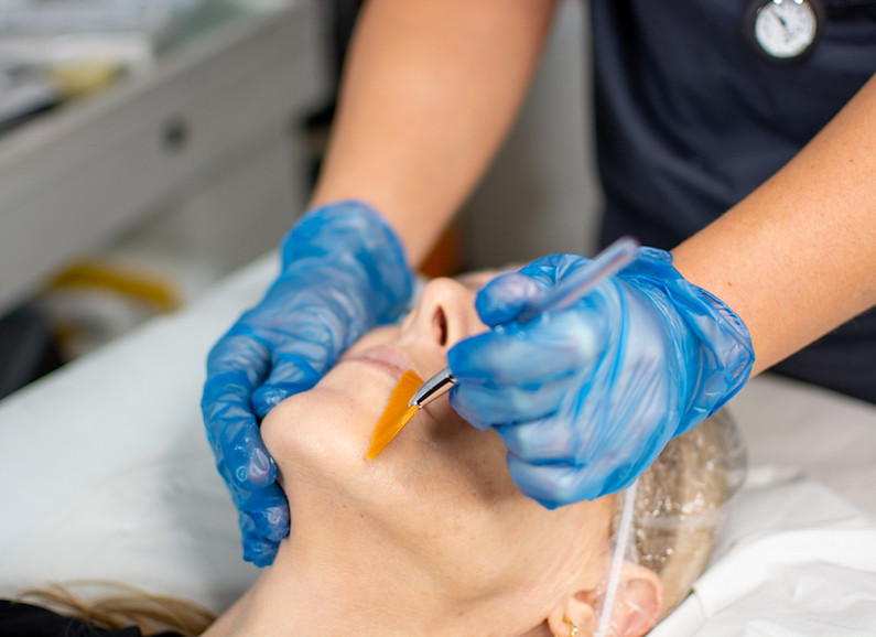 Steam Facials in Welwyn, Hertfordshire at Ink & Glow Clinic