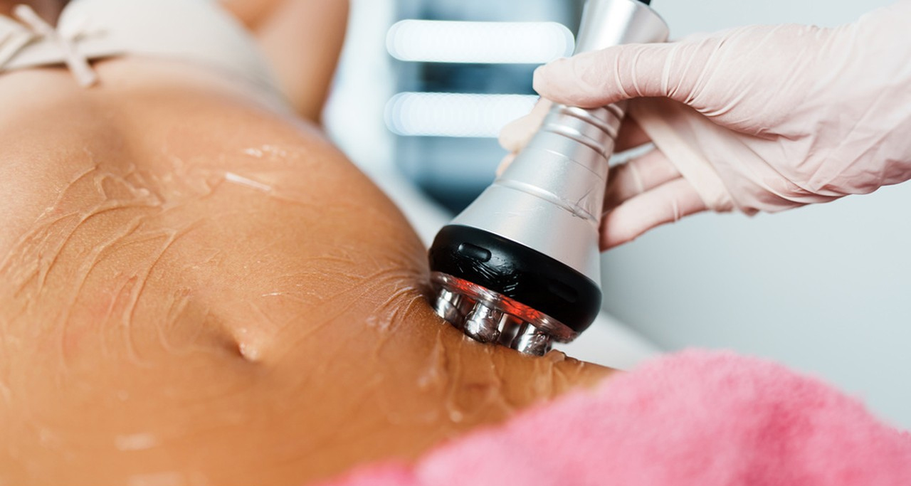 Laser Lipo vs Cavitation: Choosing the Superior Option