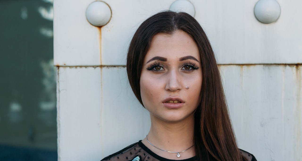 What Causes Dark Circles Under Eyes?