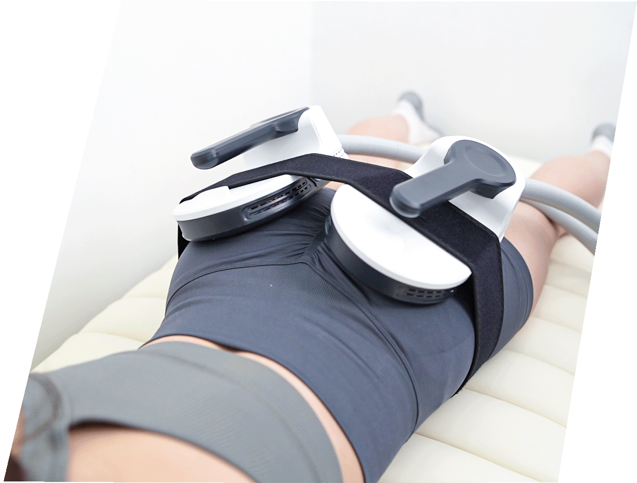 Ems Sculpt autobooking &ndash; Reshape
