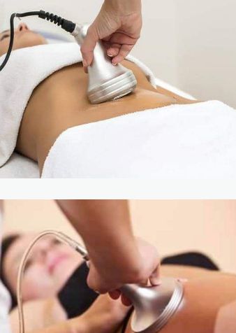 Vacuum - Expert Remodeling - Salon remodelare corporala si masaj in  Bucuresti