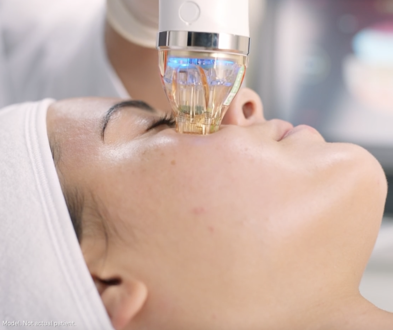 Secret RF Microneedling &mdash; The Dermatology Institute of Victoria | Melbourne  Dermatologists