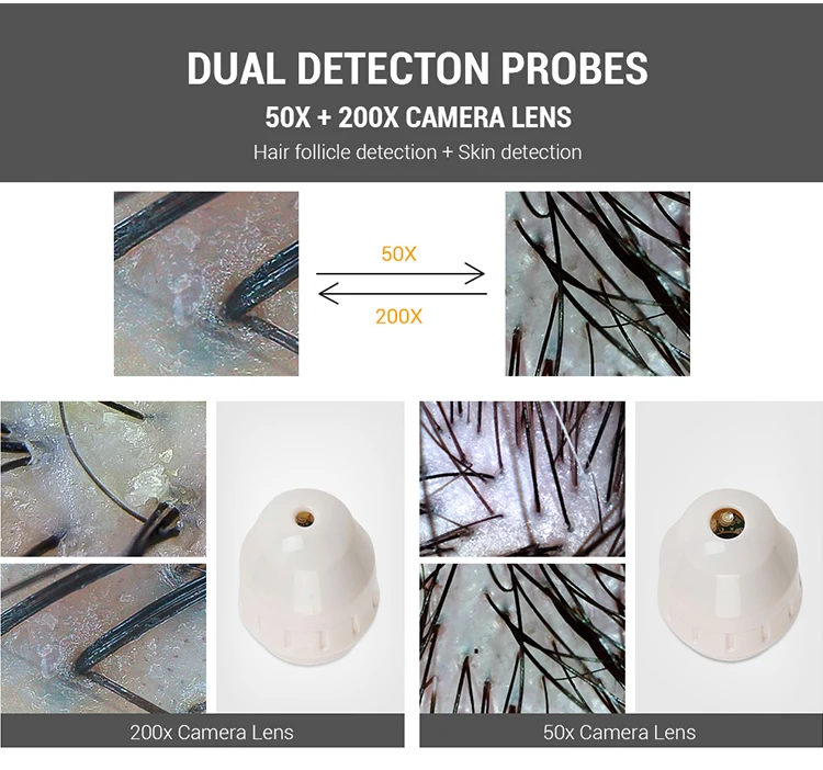 Hair Follicle Scalp Scanner - HD Analysis for Home & Commercial