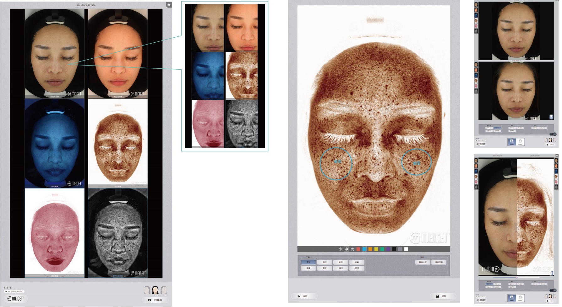 Meicet | China Professional Skin Analyzer Manufacture and Factory