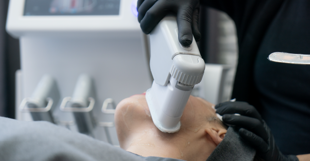 Can HIFU Treatment Replace Face Lifts?