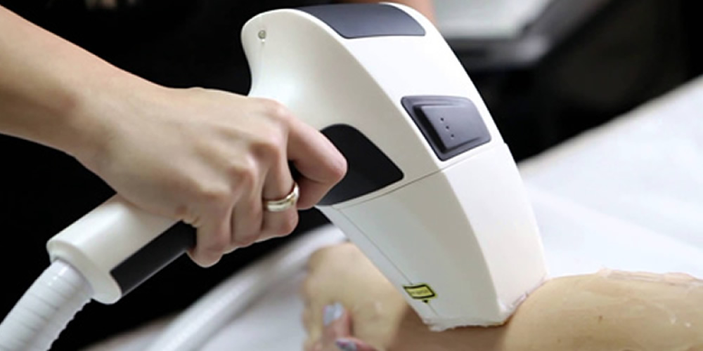 Diode Laser Hair Removal - Belladerma Beauty Academy