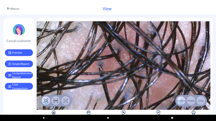 2026 High-definition Scalp Analysis 50x 200x Microscopic Hair Analysis ...