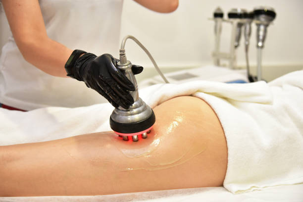 Cavitation Side Effects: What You Need to Know