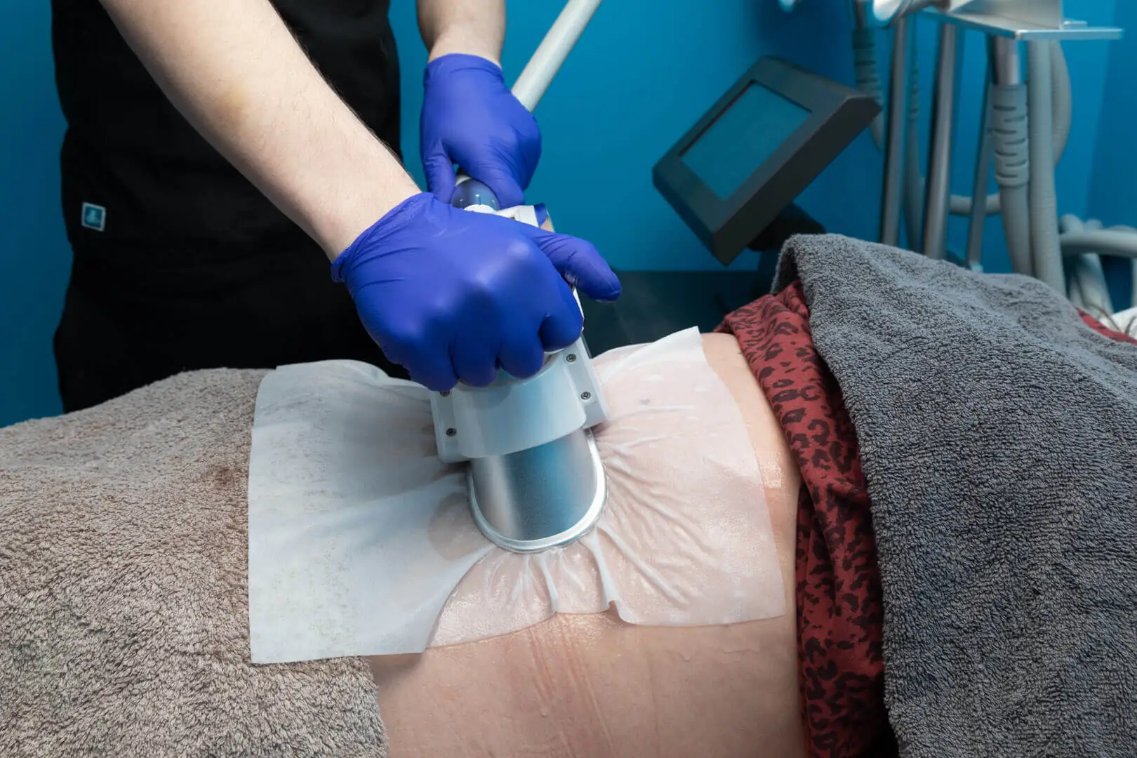 Fat Freezing Treatment Newcastle | RT Aesthetics