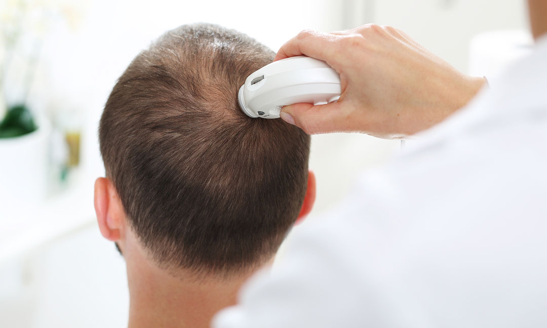 Hair and Scalp Treatment in Columbus | Dermatology Care