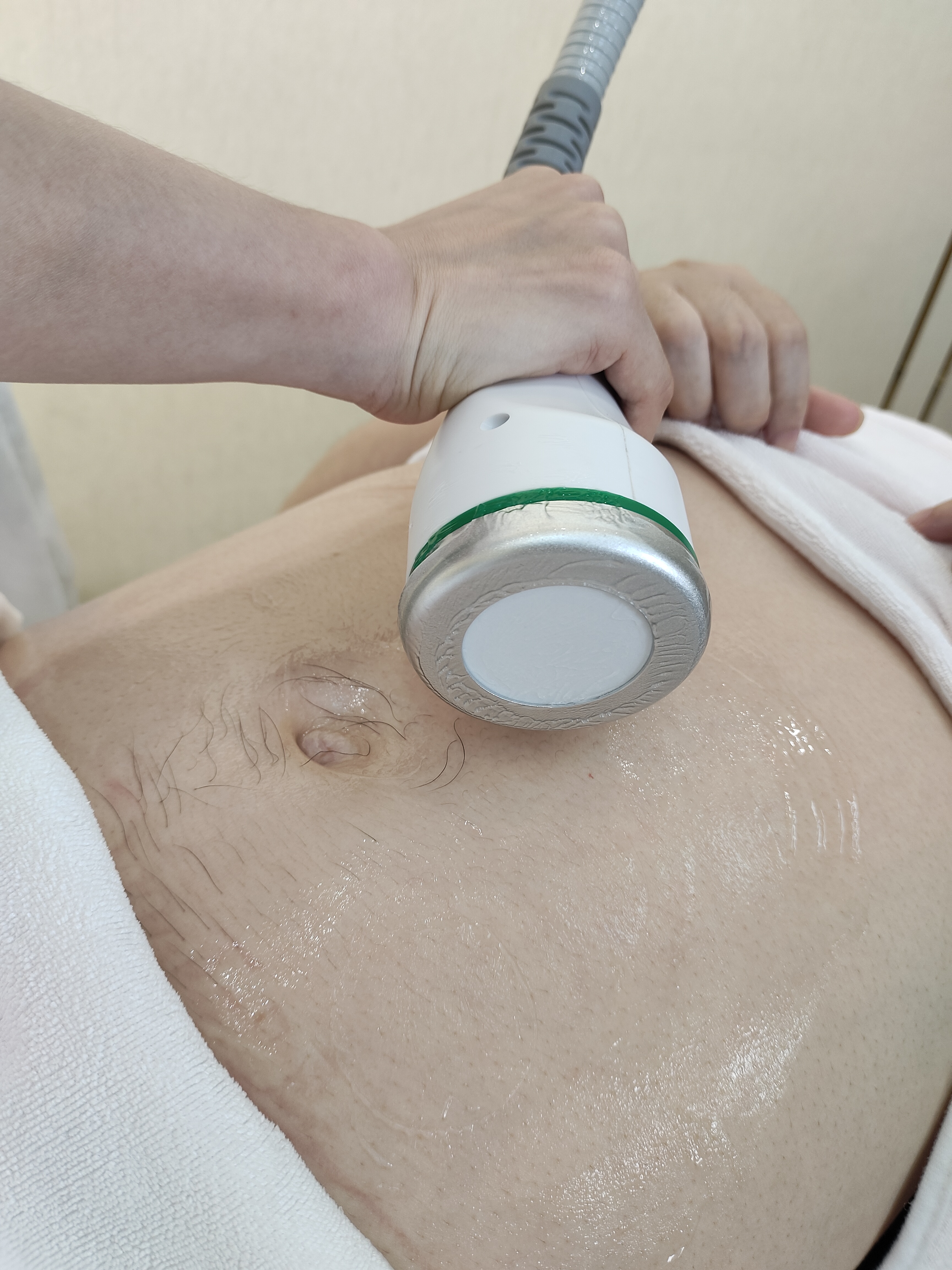 FZ-86 Coolwave Non-invasive Microwave Therapy Face lift Body Cellulite Reduction Machine