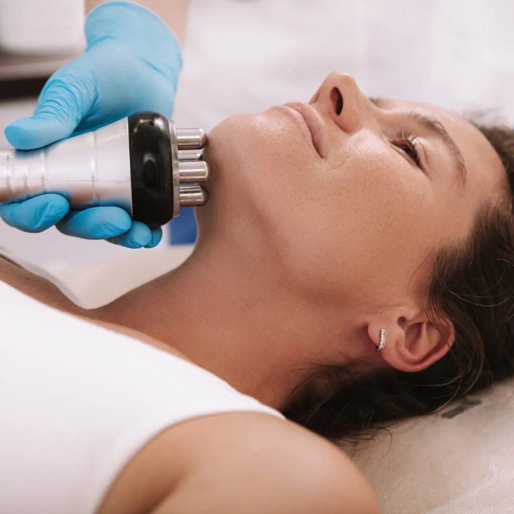 RF skin tightening - DesertBloom skincare
