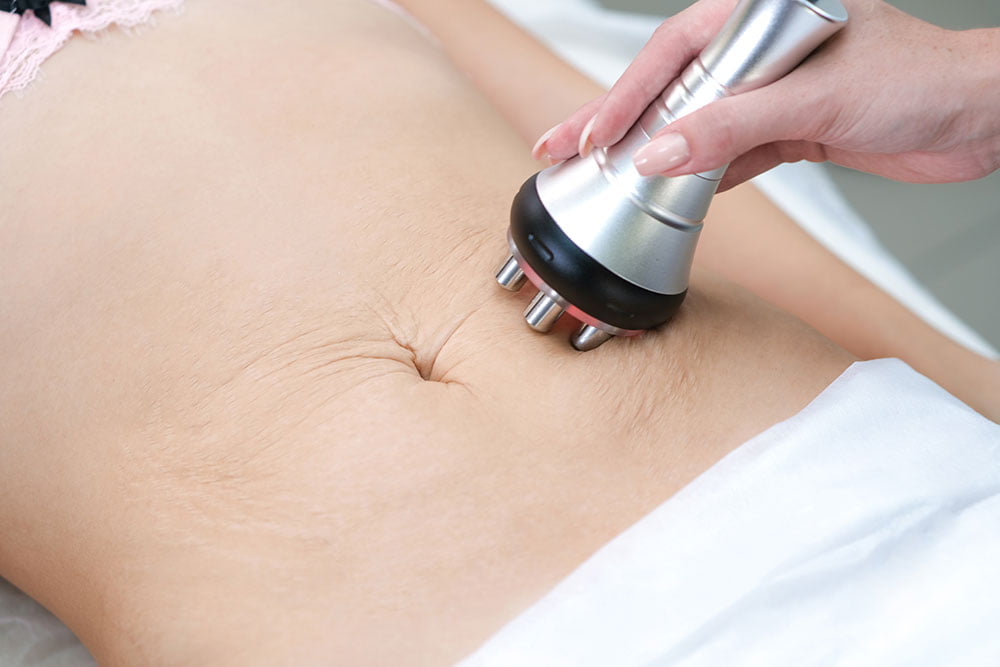 No more mummy tummy! skin tightening treatments for new mums
