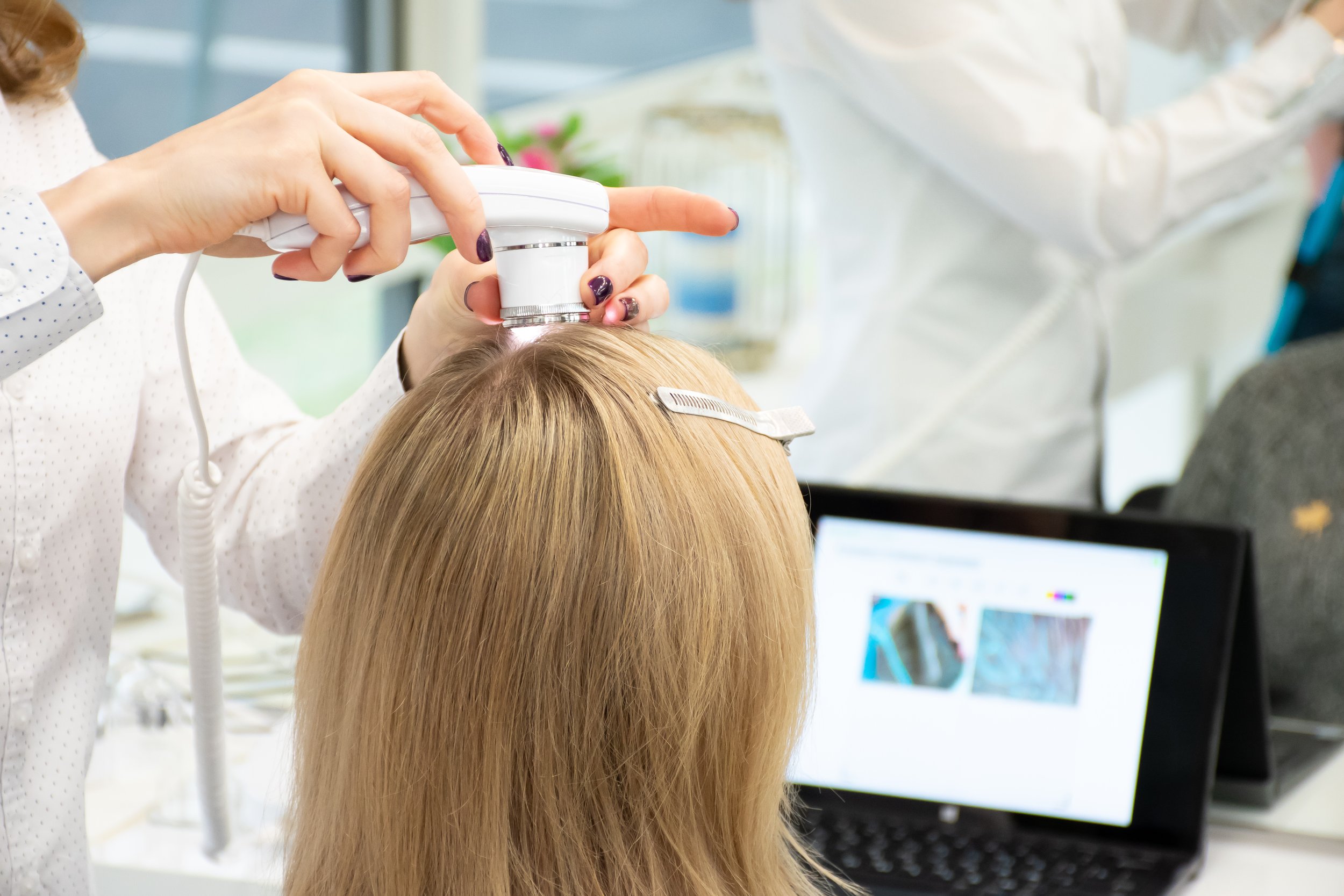 HAIR & SCALP ANALYSIS &mdash; Hair Spa