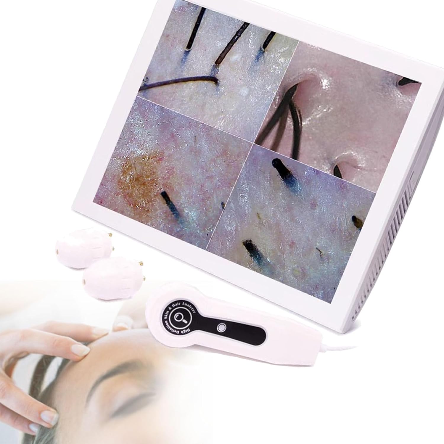 Amazon.com: SACLMD Skin Follicle Detector,15 inch Skin and Hair ...