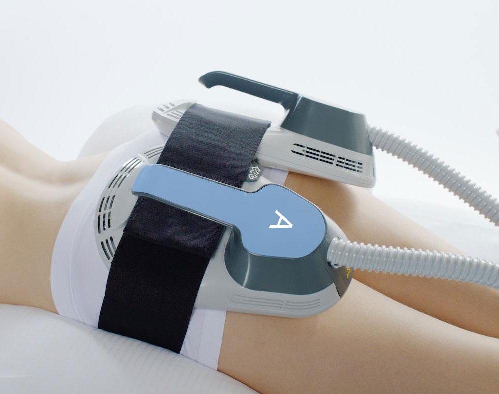 Ems Sculpting &ndash; SCULPT FS SPA