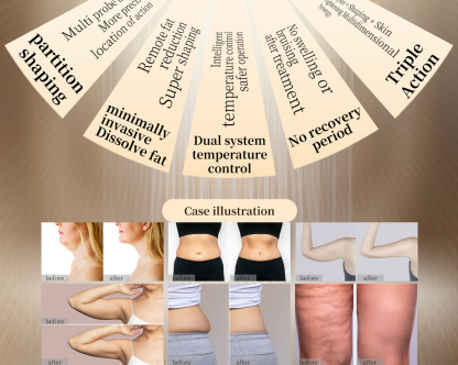 Coolwave Microwave Therapy Cellulite Reduction Face&Slimming Machine