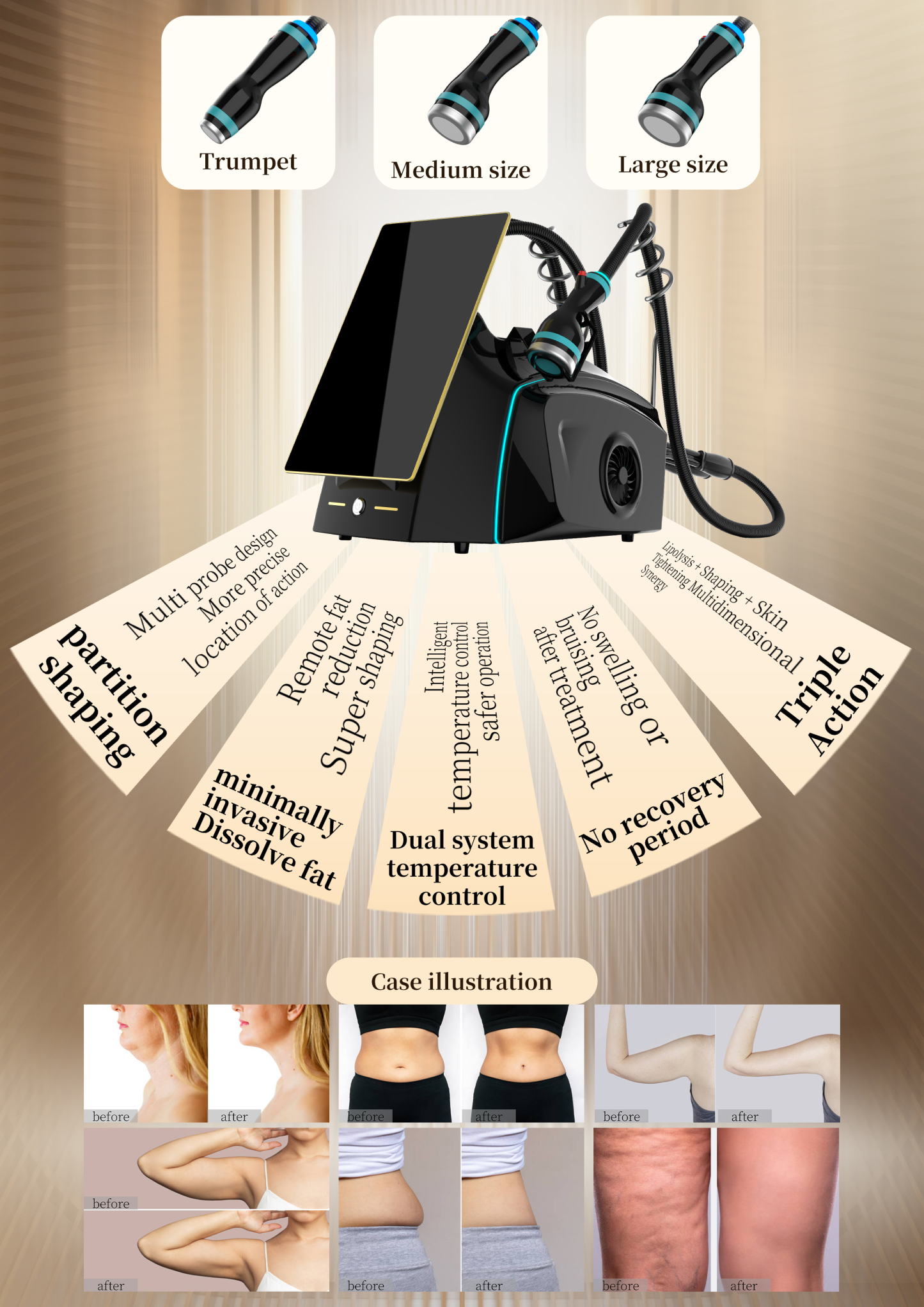 B71 Coolwaves Body Contouring Cellulite Removal Beauty Machine