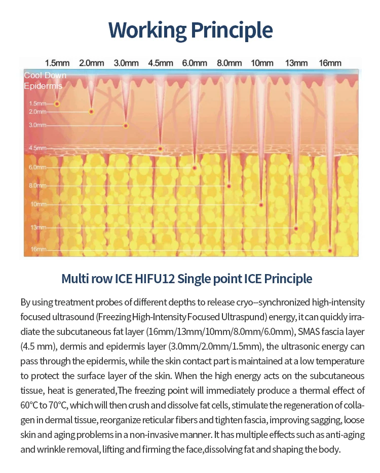 最佳冷冻Hifu机无痛Morpheus8 7厘米深度去除痤疮毛孔收缩装置冷柄射频机商业水疗使用