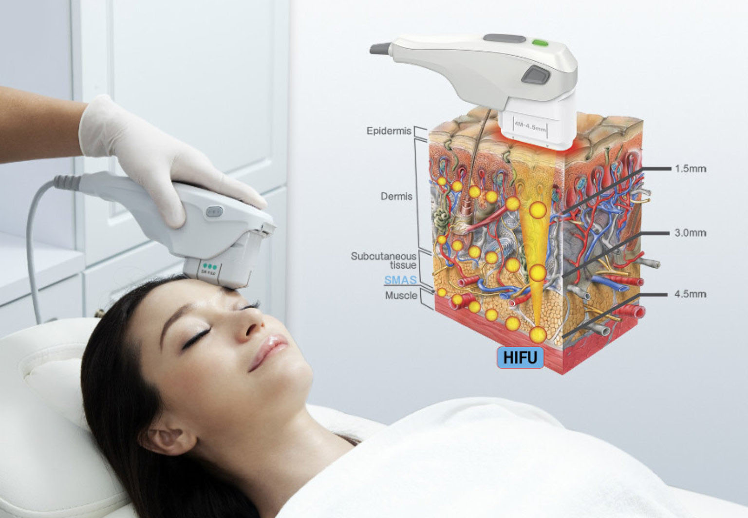 Face and Body Applications of HIFU Technology-GLM Beauty Spa Equipment Factory