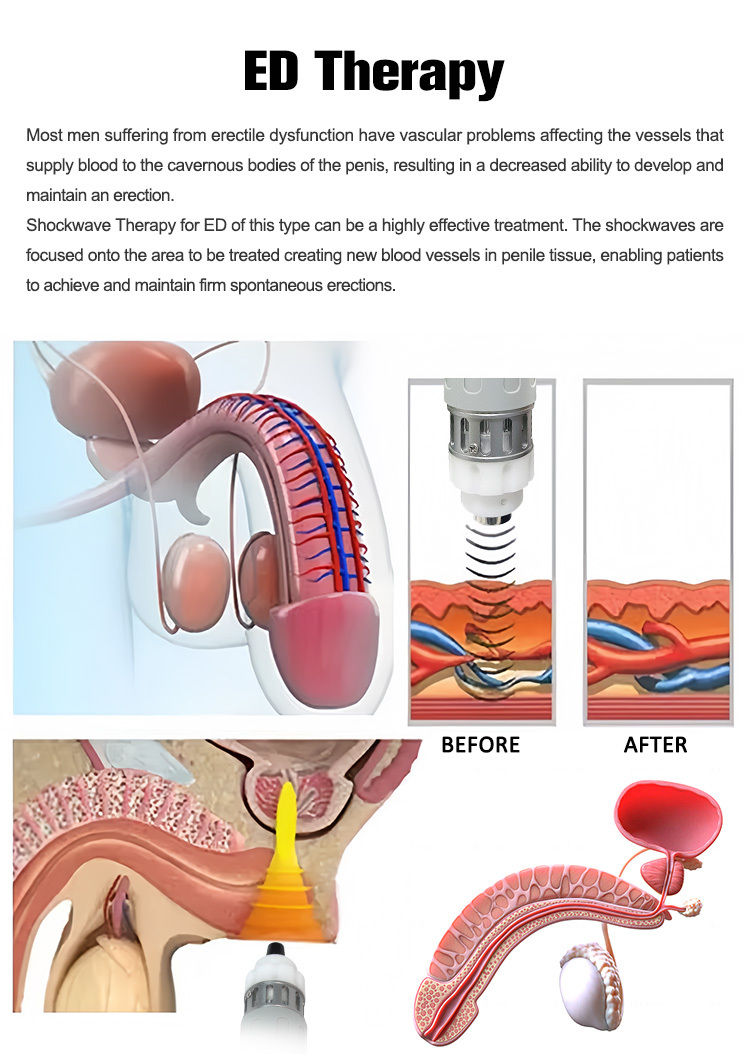 SW931 3IN1 Shock Wave EMS Pressotherapy Lymphatic Drainage Pain Relief Machine