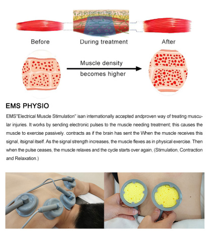 SW931 3IN1 Shock Wave EMS Pressotherapy Lymphatic Drainage Pain Relief Machine