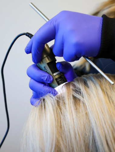The First Step to Hair Restoration: Professional Scalp Analysis-GLM Beauty Spa Equipment Factory