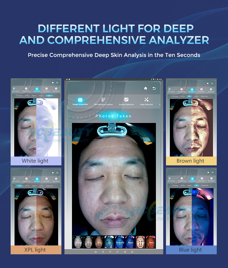 3D Facial Analysis Smart Skin Analyzer Face Skin Test Analyzer Face ...