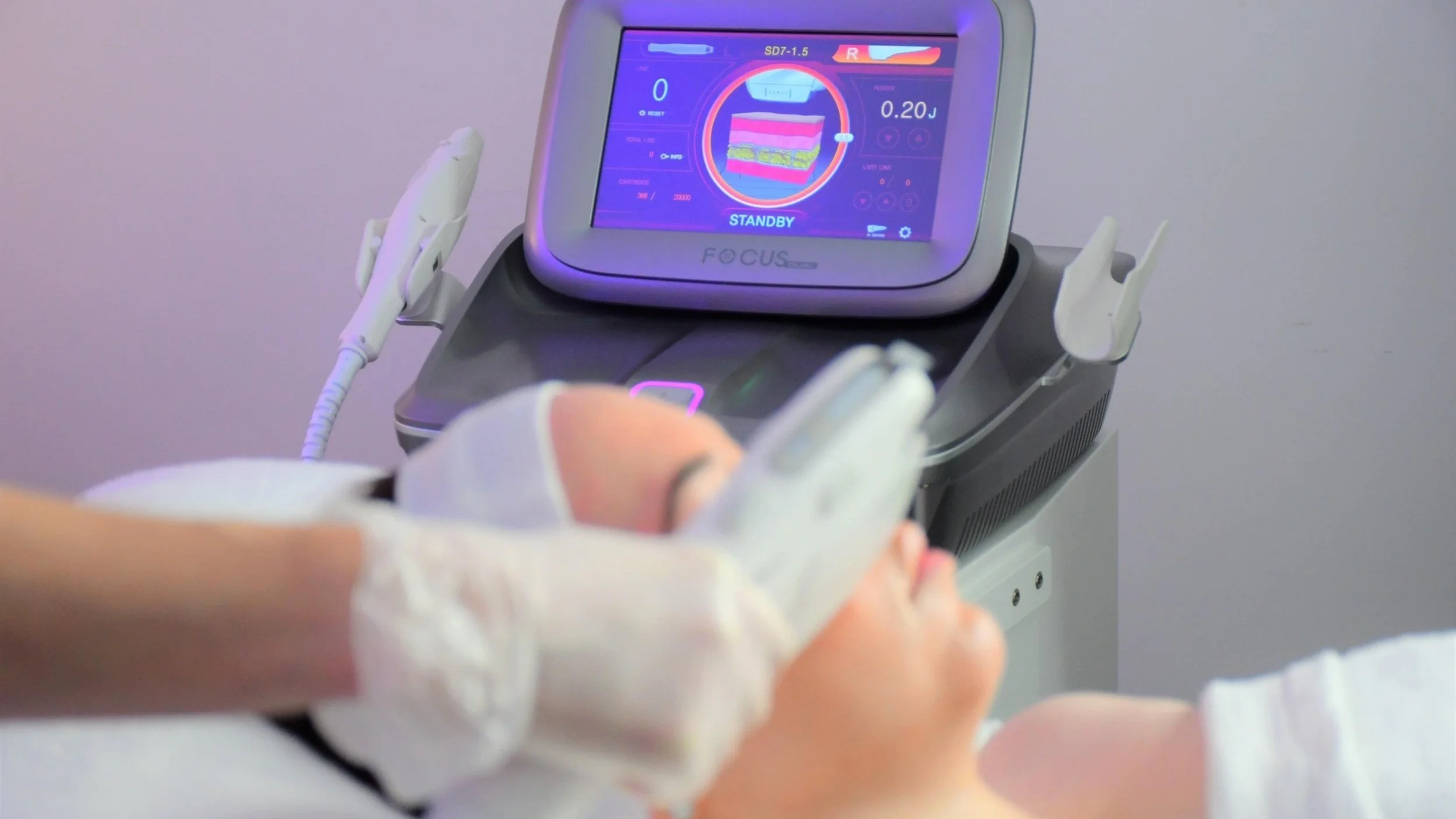 Focus Dual: HIFU & Radiofrequency Microneedling | SKINLAB Clinic Deal