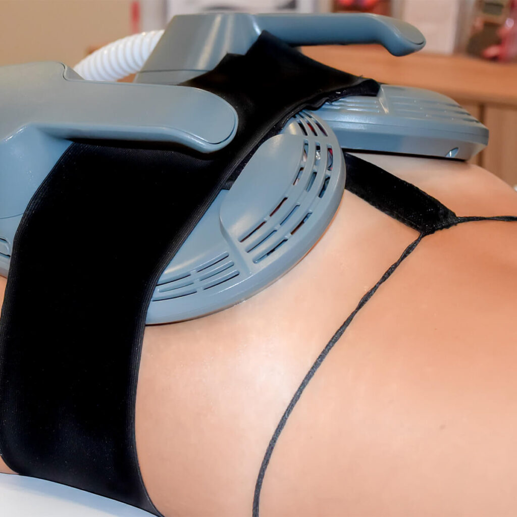 Our Advanced Bodysculpt Ems Device | Body Lab Studios