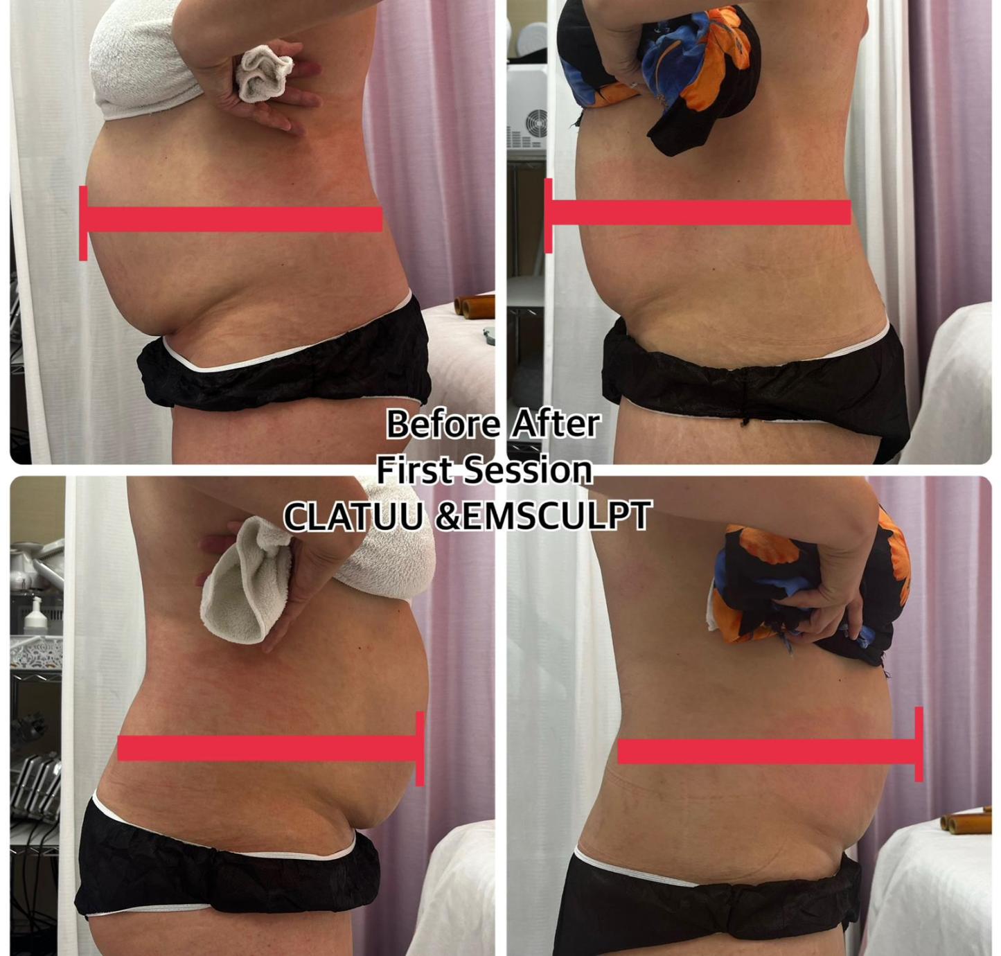 F39 2in1 Emslim EMS sculpting HIFEM Cryolipolisis 360 Cryo Therapy Fat Freezing Body Slimming Machine