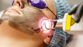 Laser Spot Removal 的图像结果