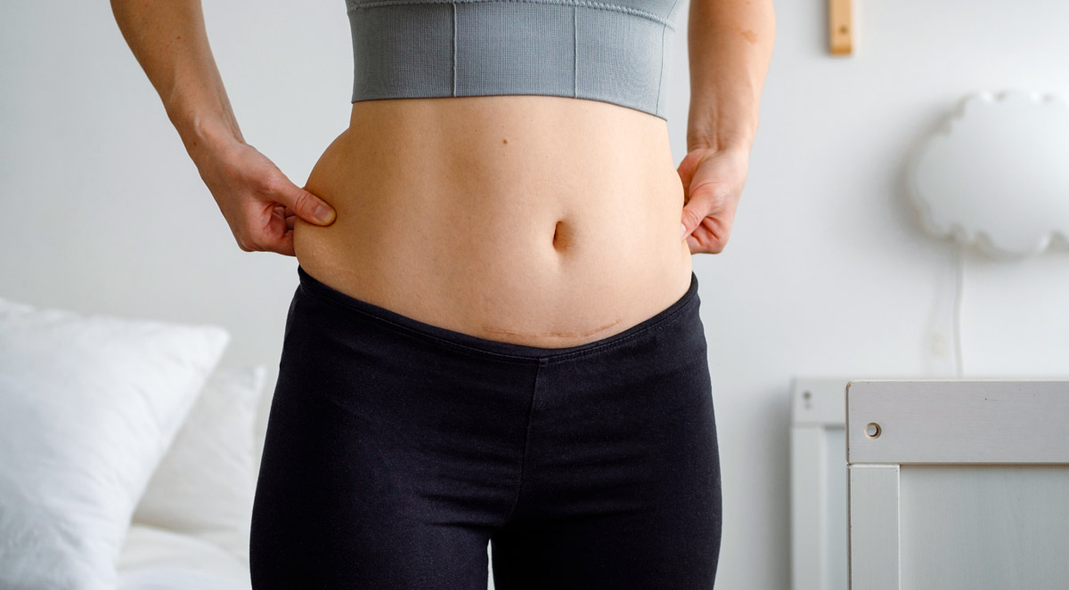 How to Lose Belly Fat Fast: Proven Strategies That Actually Work in ...