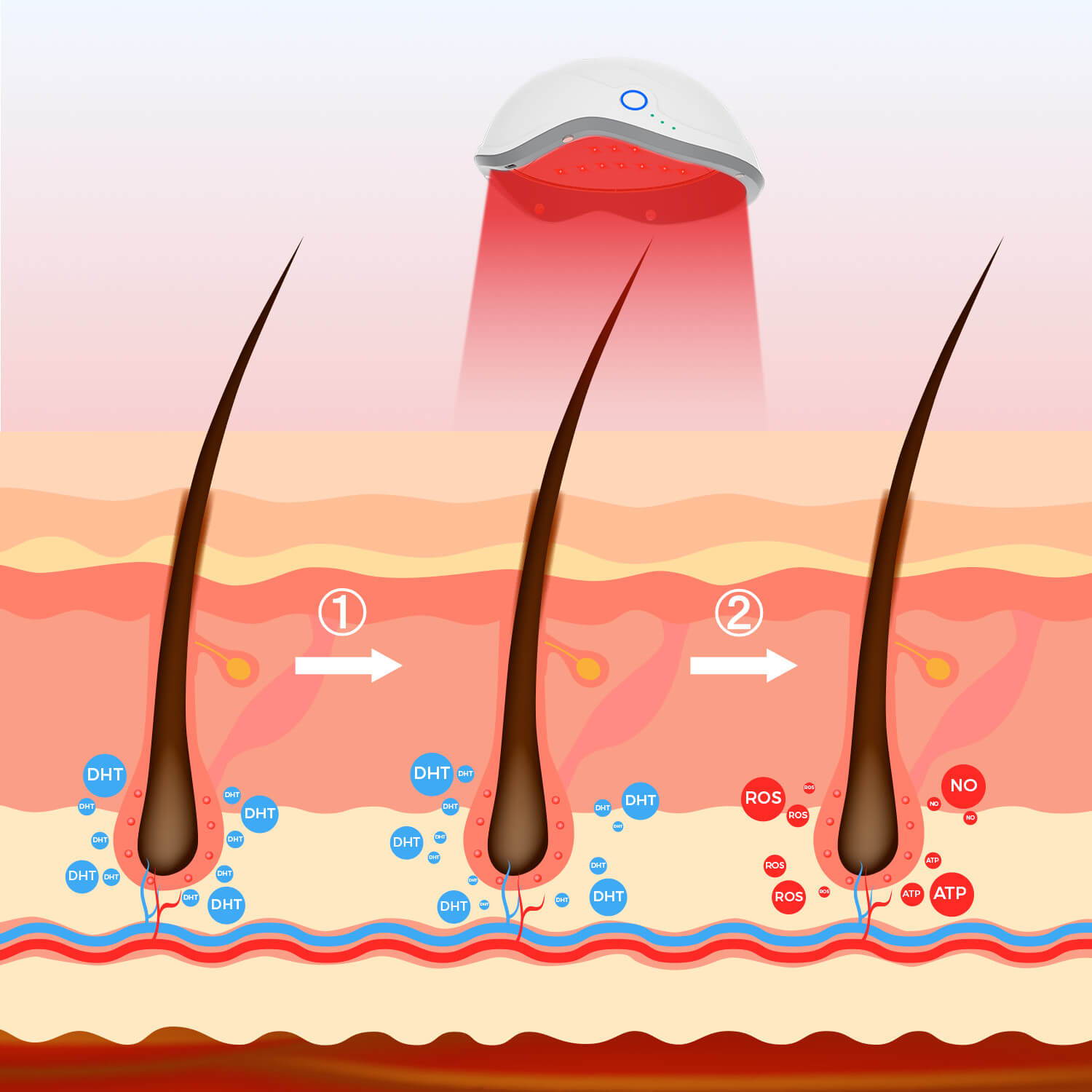 FDA-Cleared Laser Hair Growth Helmet - Promote Hair Growth & Prevent ...