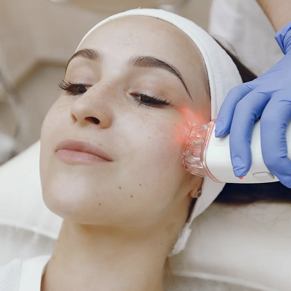 RF Microneedling - La Belle et Michelle