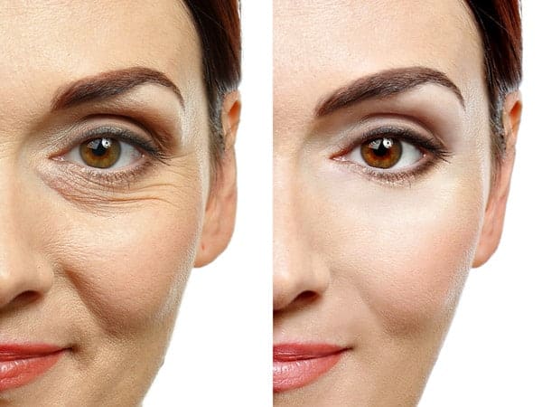 Collagen Facial | Winston Salem Dermatology