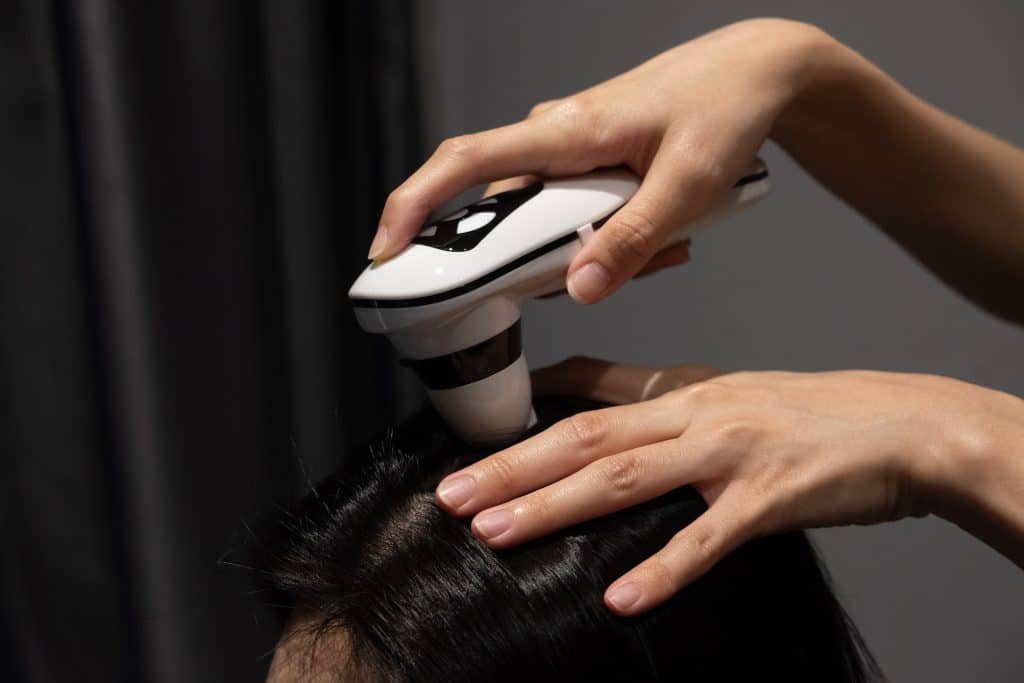 Guide to Microneedling for Hair loss: How to Make it Work - TrichoLab