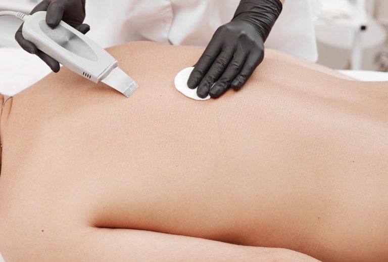 Acne Facial Treatment in Singapore | Eeva Medical Clinic