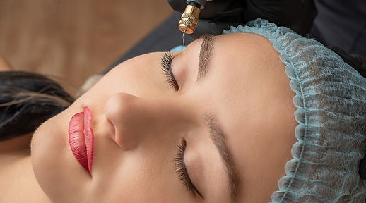 Plasma Lift | Flawless Skin Lounge