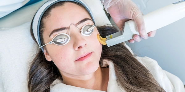 Nd:YAG Laser Facial Oakville | Distill Laser Clinic