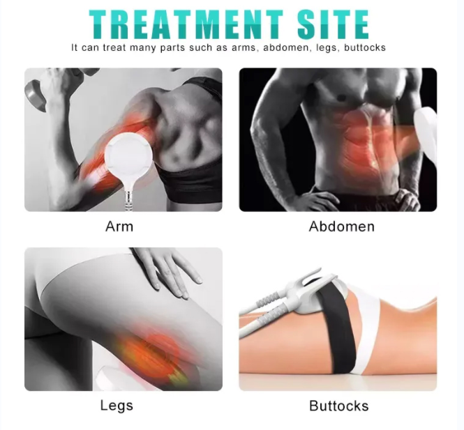 How effective is EMS sculpting for muscle building?