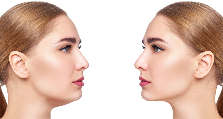 How to Get a Sculpted Jawline Without Surgery