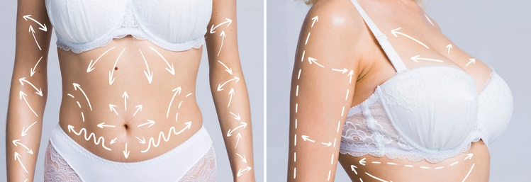 How Does Fat Leave the Body When You Lose Weight?-GLM Beauty Spa Equipment Factory