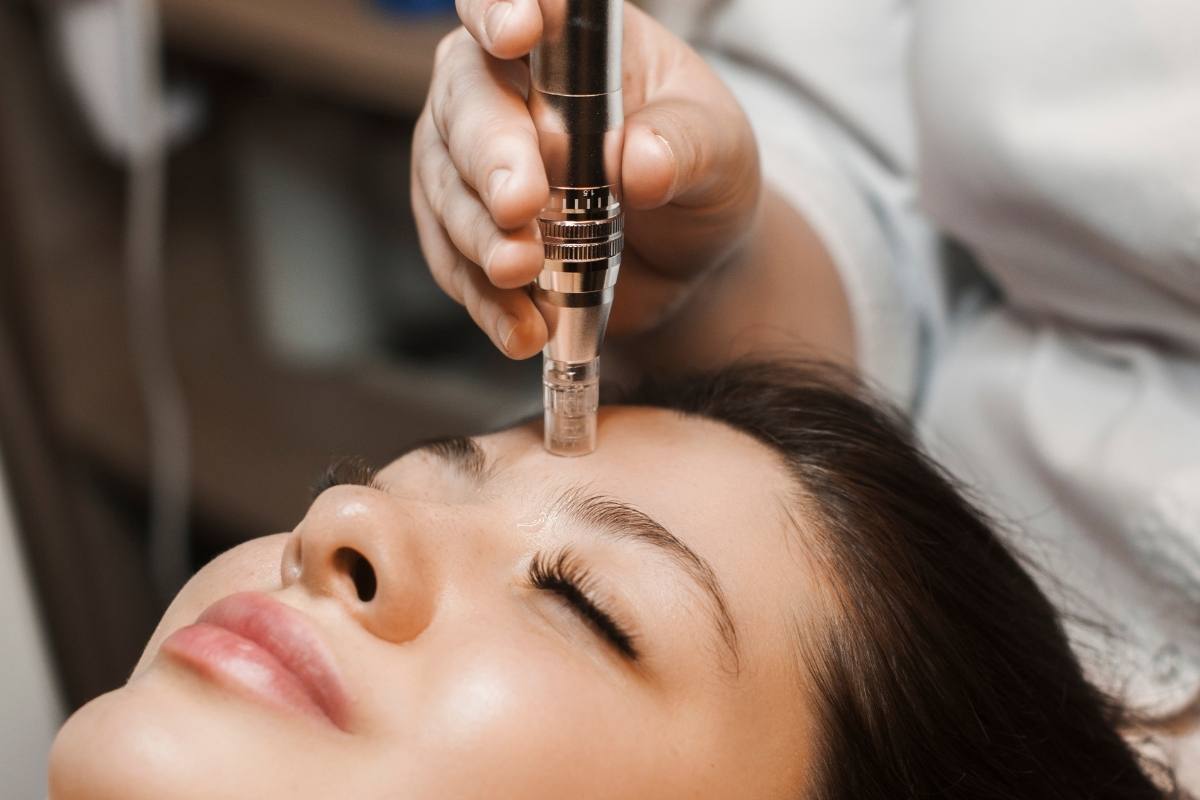 From Collagen Boost to Scar Repair: What Microneedling Truly Does for Your Skin-GLM Beauty Spa Equipment Factory