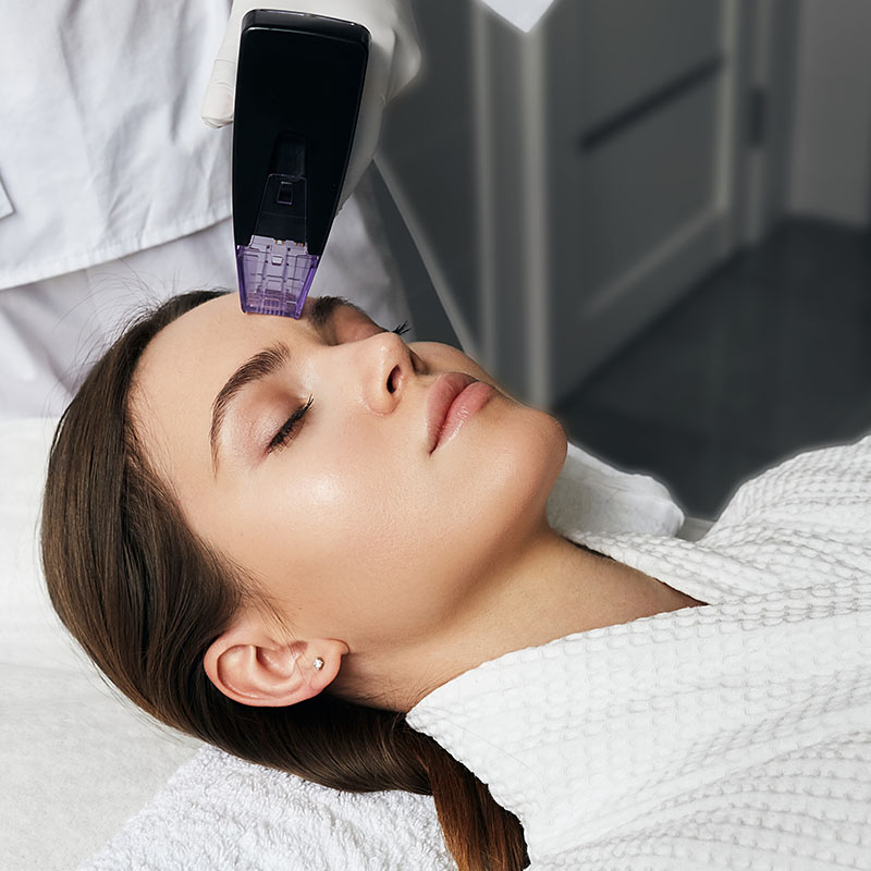 Gold RF Microneedling vs. Laser: Which Skin Treatment Works Better? &ndash; GLM  Beauty Spa Equipment Factory