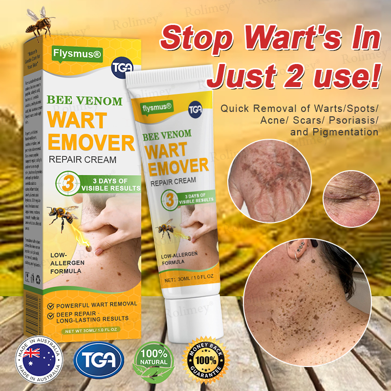 👨‍⚕️✅Pain-free flysmus® Bee Venom Wart-Removal Repair Cream—Made for all skin types (🔥Buy 1 Get 1 Free🔥)