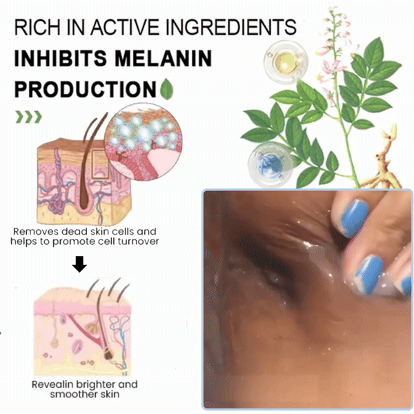 💥Buy 1 Get 1 Free ONLY TODAY💥Purifying Enzymes Exfoliating Gel(Face&Body Suit)