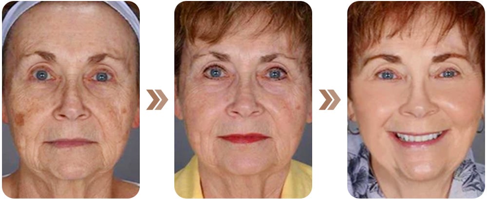 𝗝𝗼𝗿𝗼𝗻𝗱𝘆® Honey Tear-Off Mask Anti-Aging